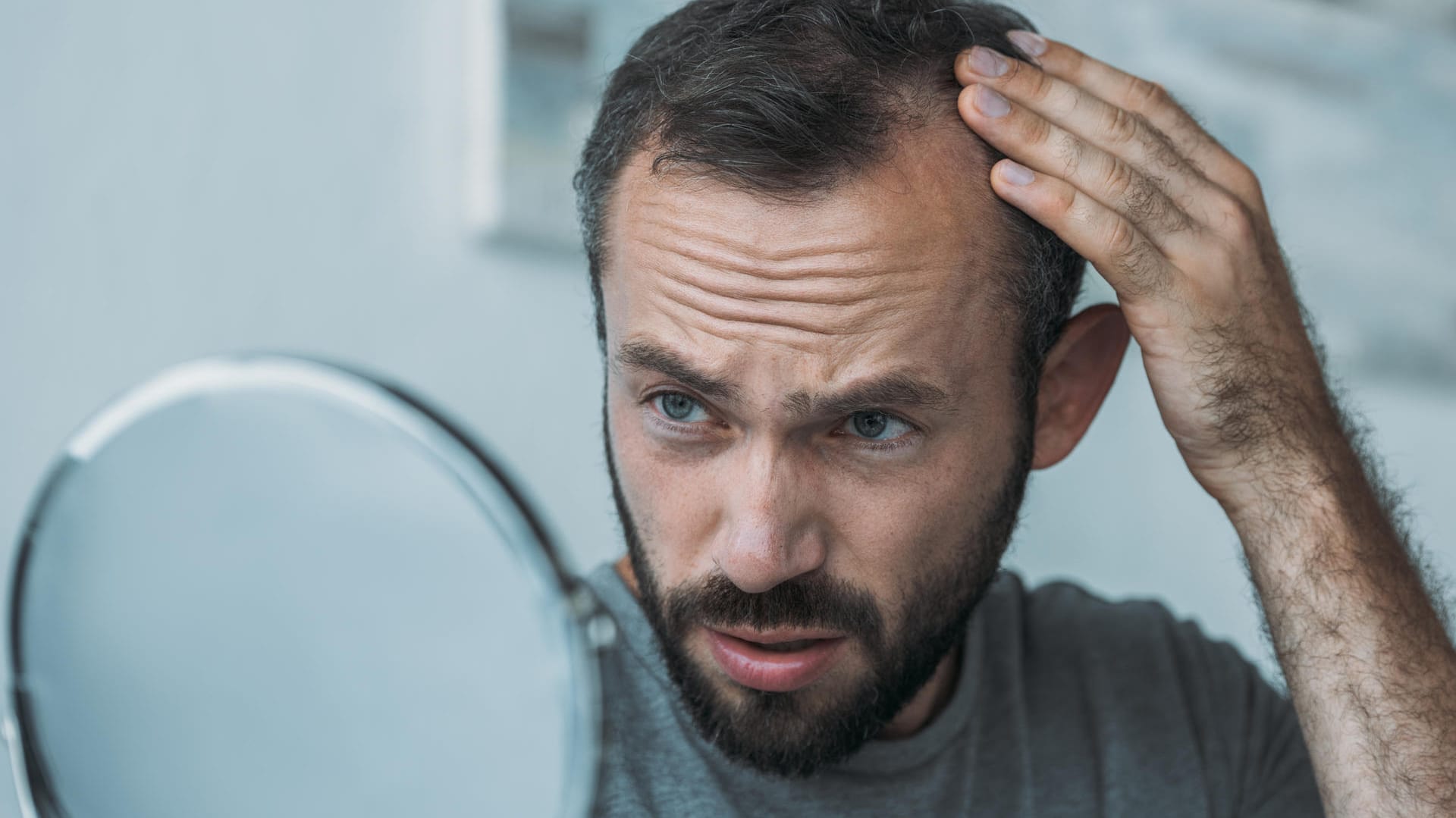 Schock beim Blick in den Spiegel: Bei vielen Männern ist Haarausfall genetisch bedingt.