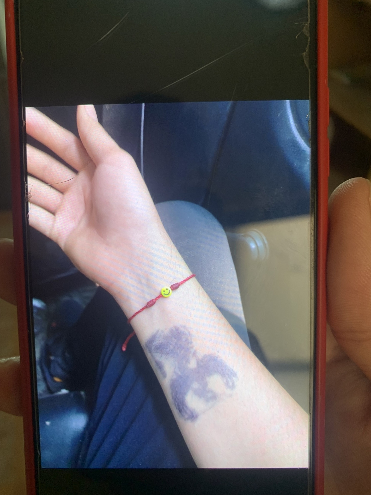 Zahlungsbeleg: Allan Mejía zeigt ein Foto, auf dem der Stempel zu sehen ist, den er nach seiner Entführung auf den Unterarm gedrückt bekam.