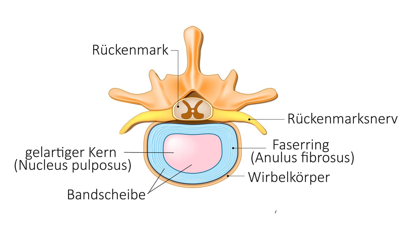 Anatomische Darstellung von Wirbel und Bandscheibe (Blick von oben). Anatomische Darstellung von Wirbel und Bandscheibe (Blick von oben).