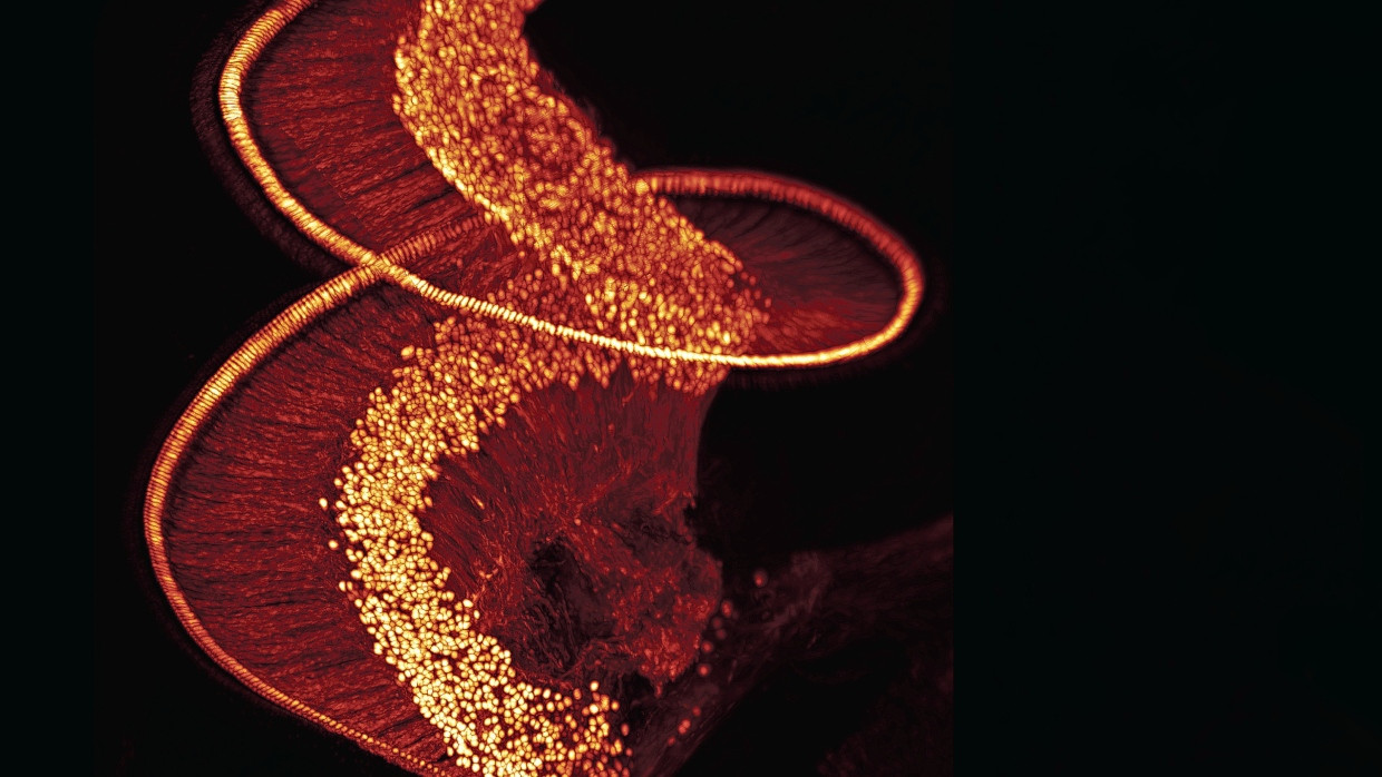 Blick ins Innere der Hörschnecke: Die runden Zellen der Hörnervenzellen formen das Spiralganglion im Zentrum. Die Nervenfortsätze kontaktieren sowohl die Haarsinneszellen in der äußeren Spirale als auch den Hörnerv.