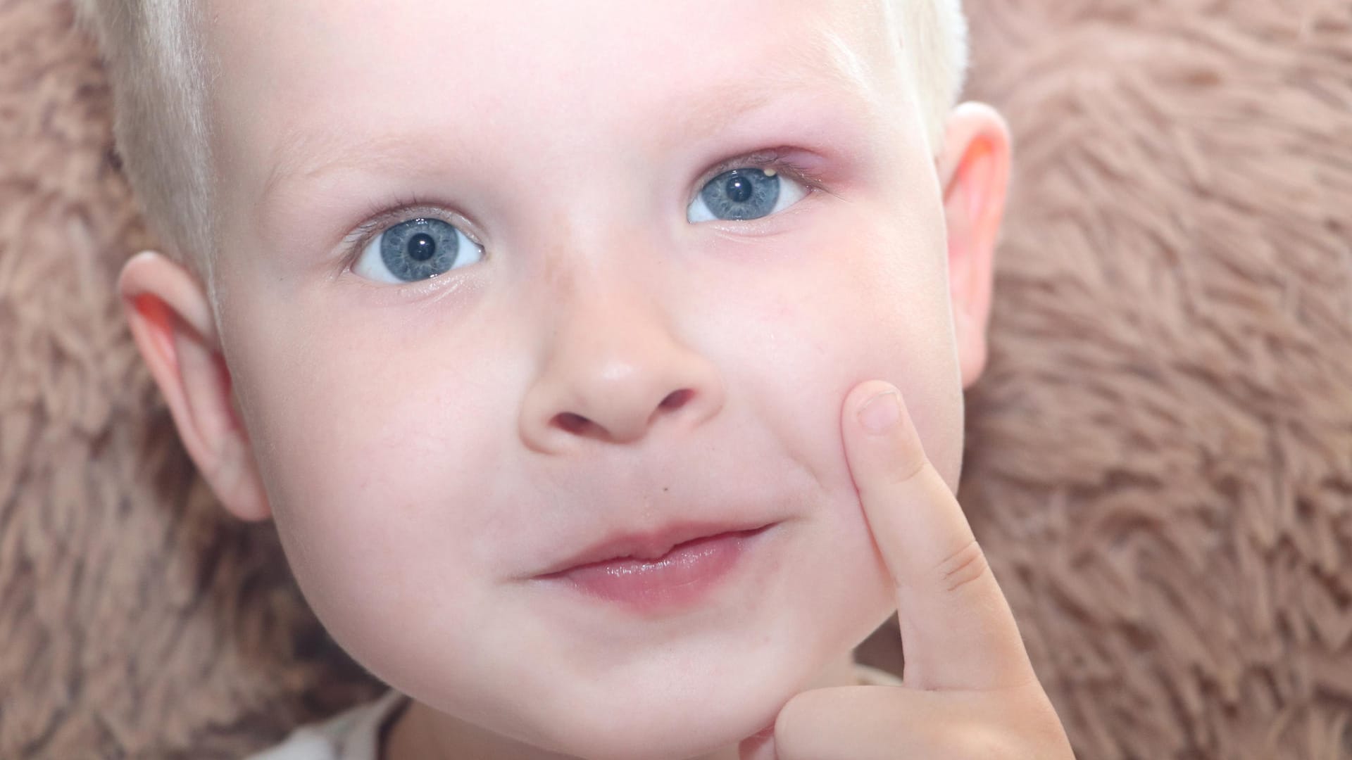 Gerstenkorn: Auch Kinder können daran erkranken. Gerstenkorn: Auch Kinder können daran erkranken.