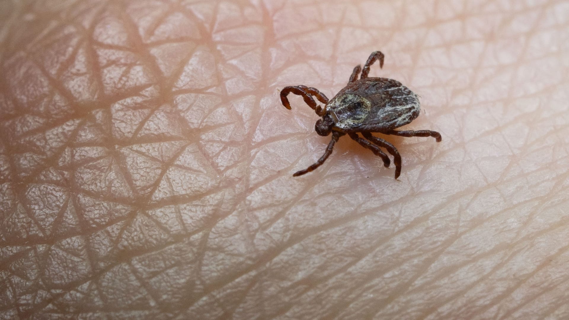 Zecken: Das FSME-Virus, mit dem sich Zecken infizieren, kann an den Menschen weitergeben werden. Zecken: Das FSME-Virus, mit dem sich Zecken infizieren, kann an den Menschen weitergeben werden.