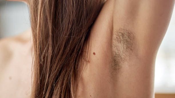 Seltener Anblick: Die Mehrheit der Frauen entfernt ihre Achselbehaarung. Seltener Anblick: Die Mehrheit der Frauen entfernt ihre Achselbehaarung.