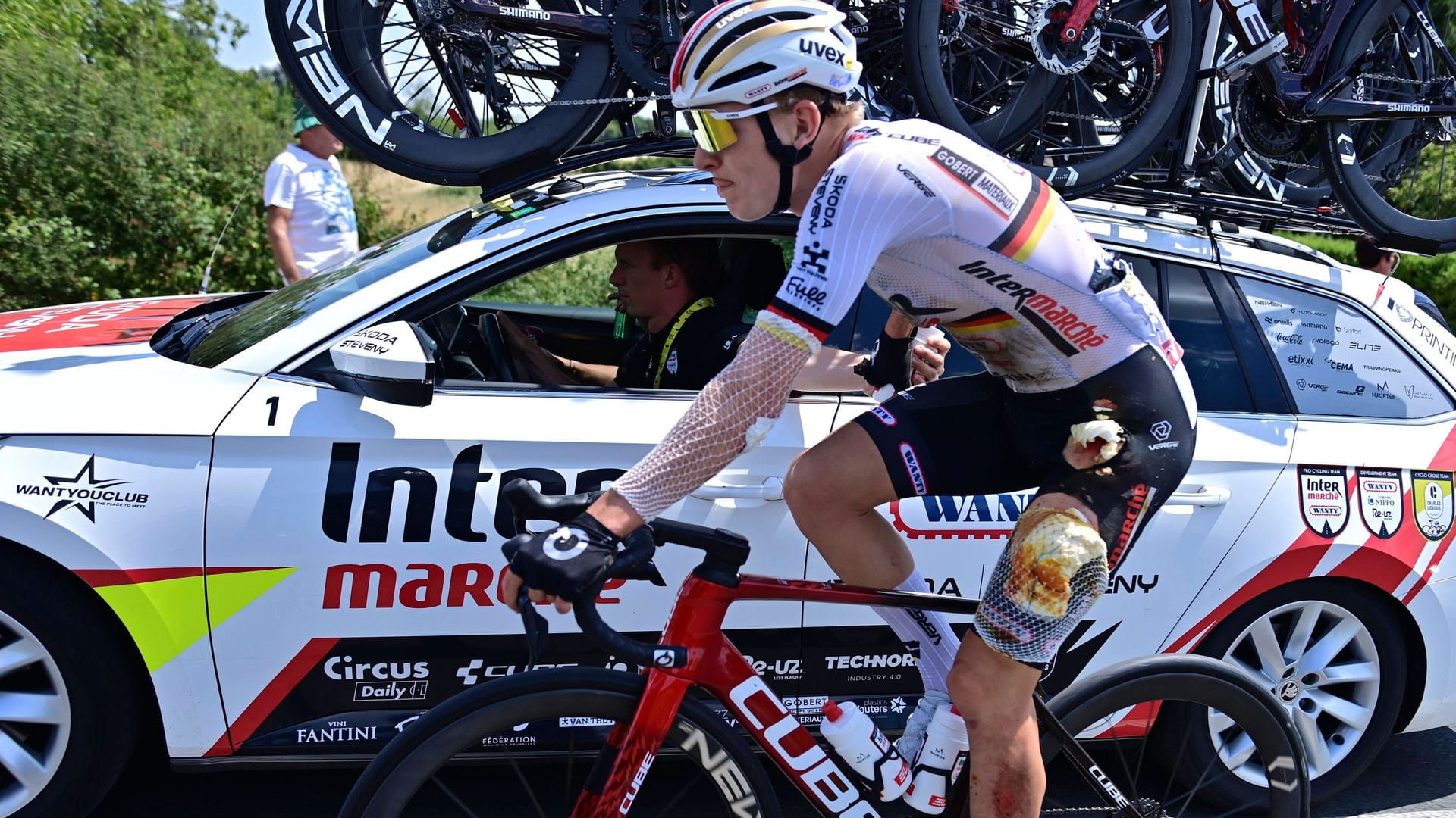 Georg Zimmermann mit seinen Wunden: Der deutsche Radsportler stürzte am Sonntag. Georg Zimmermann mit seinen Wunden: Der deutsche Radsportler stürzte am Sonntag.